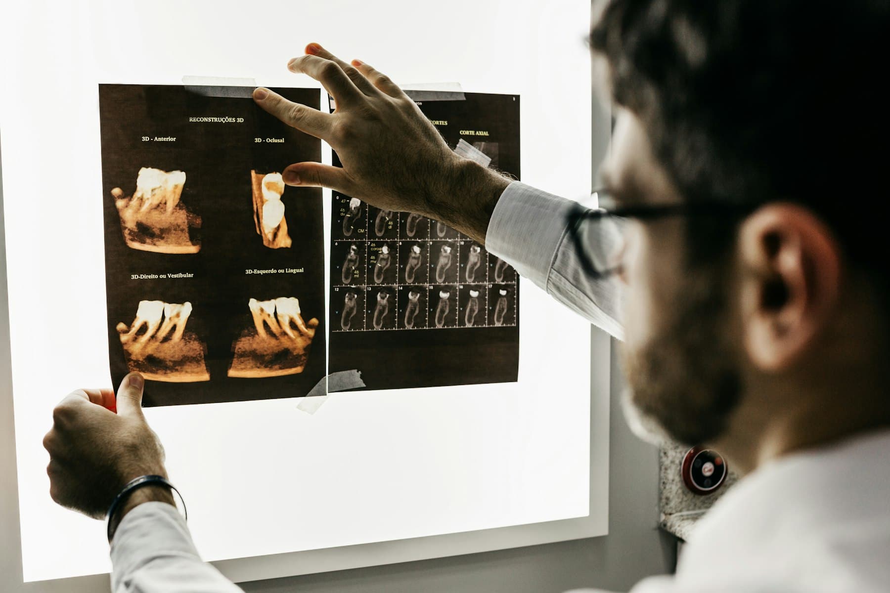 Dr. Reyes reviewing a 3D dental scan on a lightboard before explaining the treatment plan